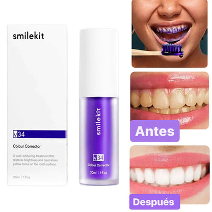 DentesLixívia™ - Blanqueador Dental v34 (COMPRA 1 Y LLÉVATE 1 GRATIS)